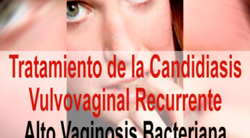 Tratamiento de la Candidiasis Vulvovaginal Recurrente – Alto Vaginosis Bacteriana