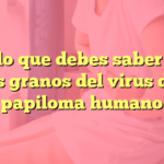 Todo lo que debes saber sobre los granos del virus del papiloma humano